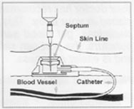 Diagram of port in use